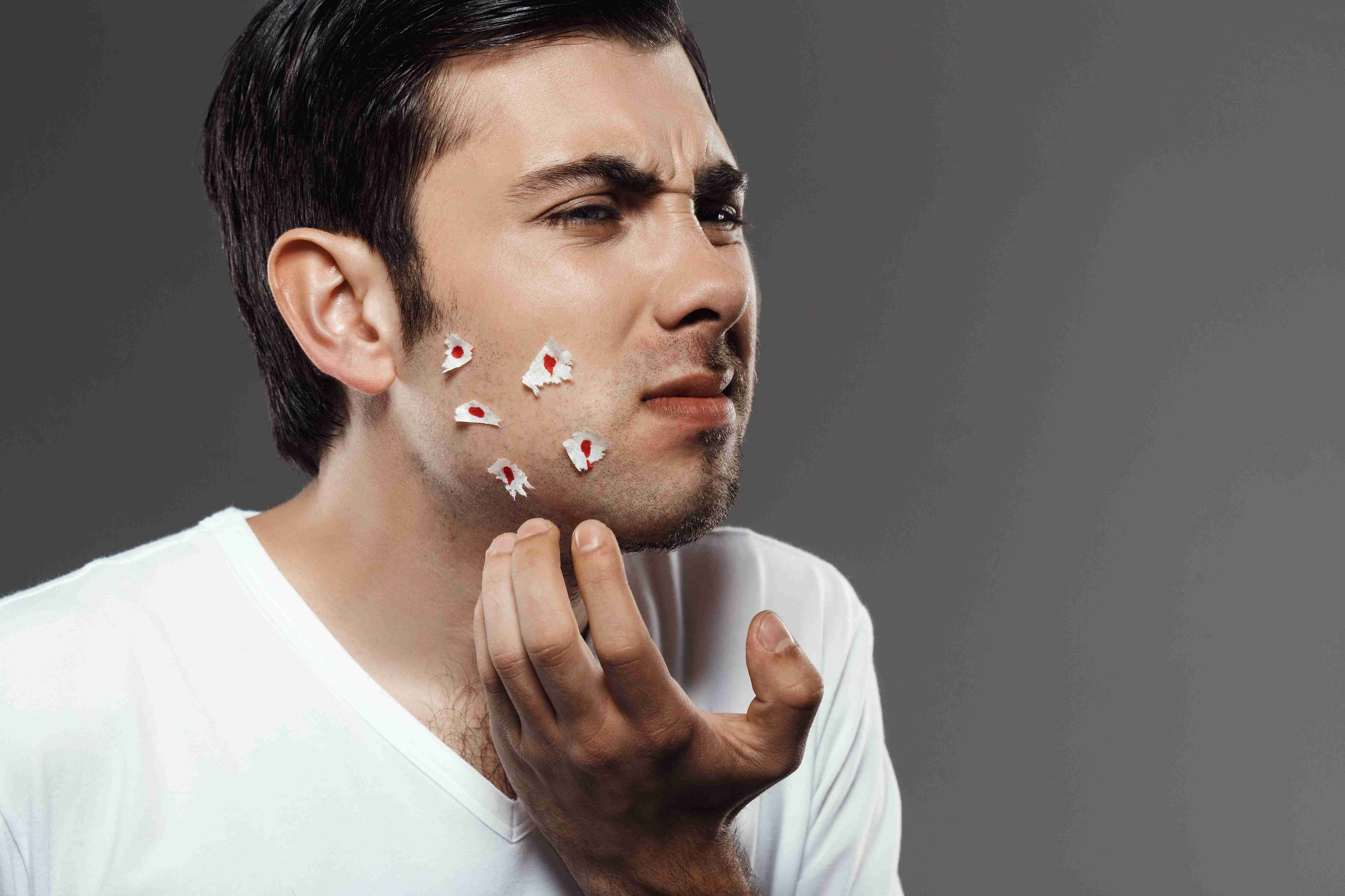 Types of acne scars