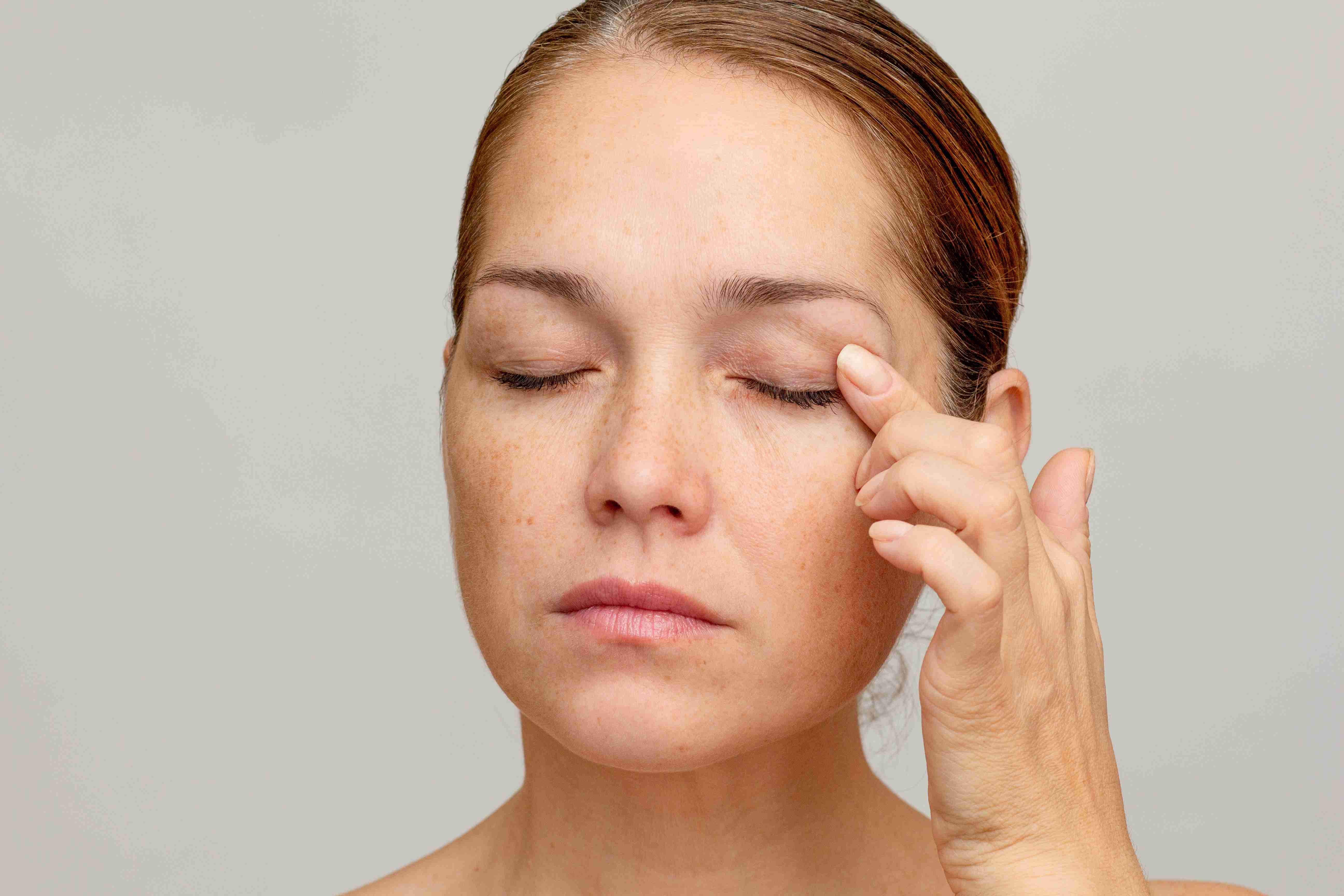 Causes of under-eye pigmentation and hollowness