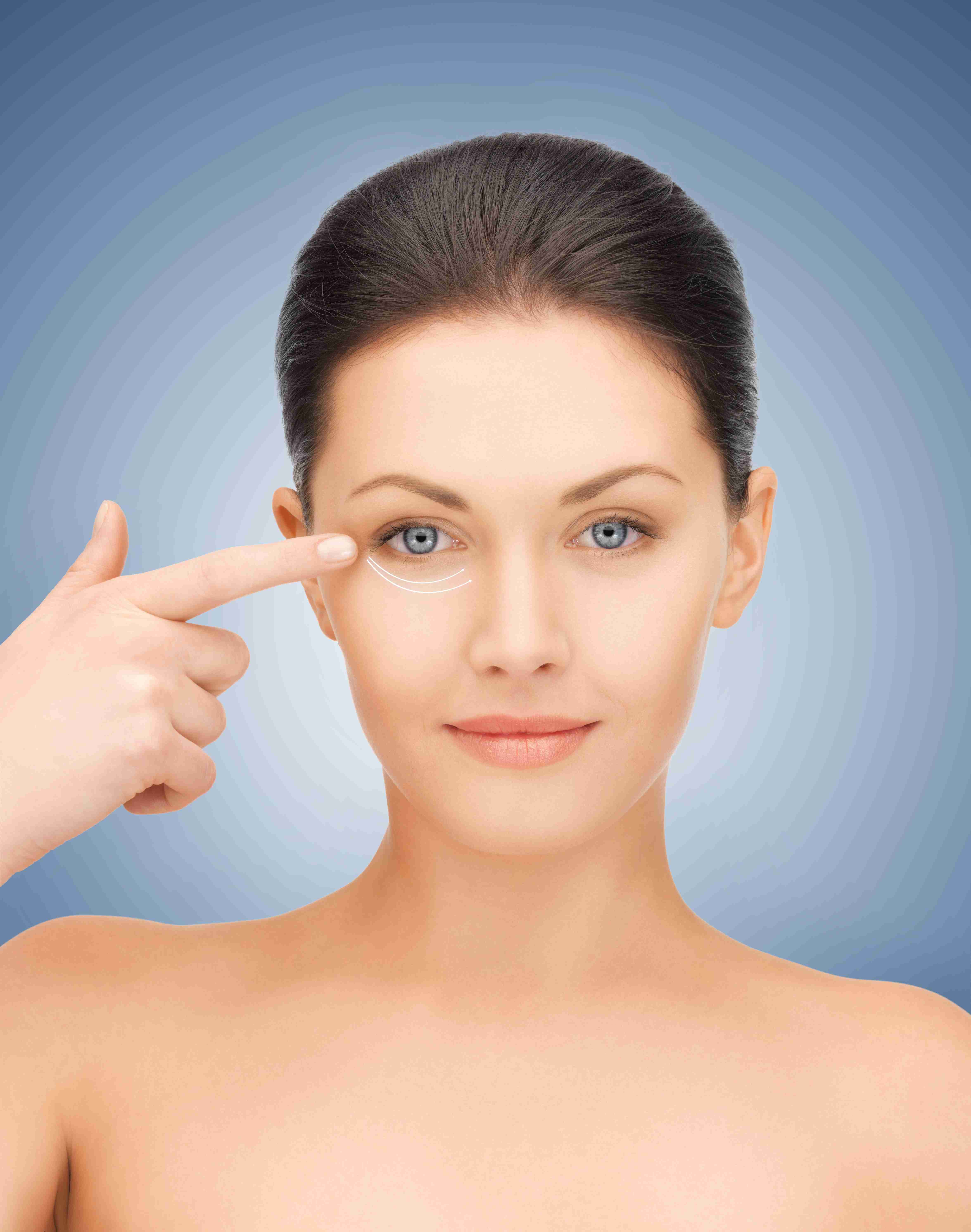 Different types of dark circles around the eyes
