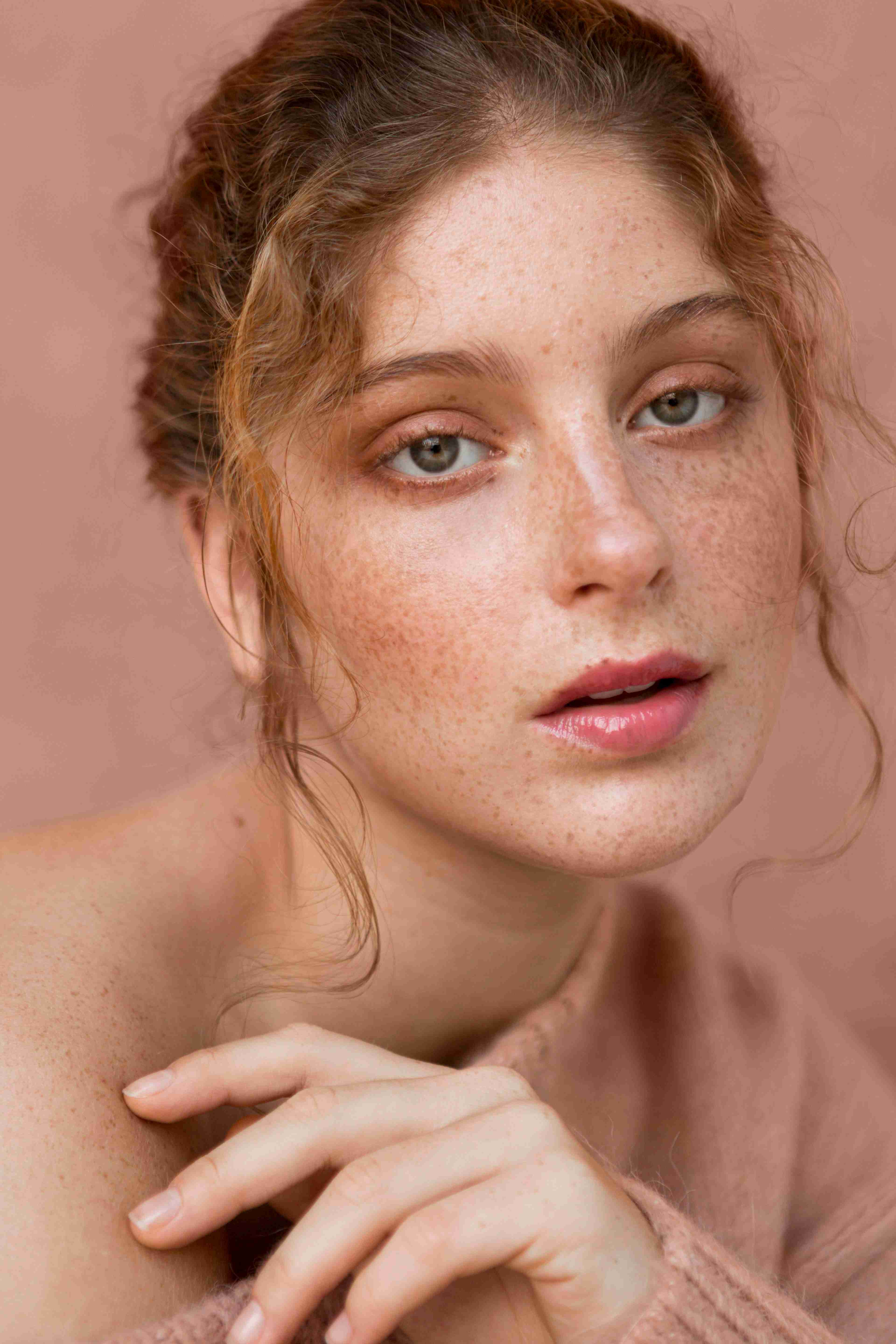 Freckles on nose and cheeks