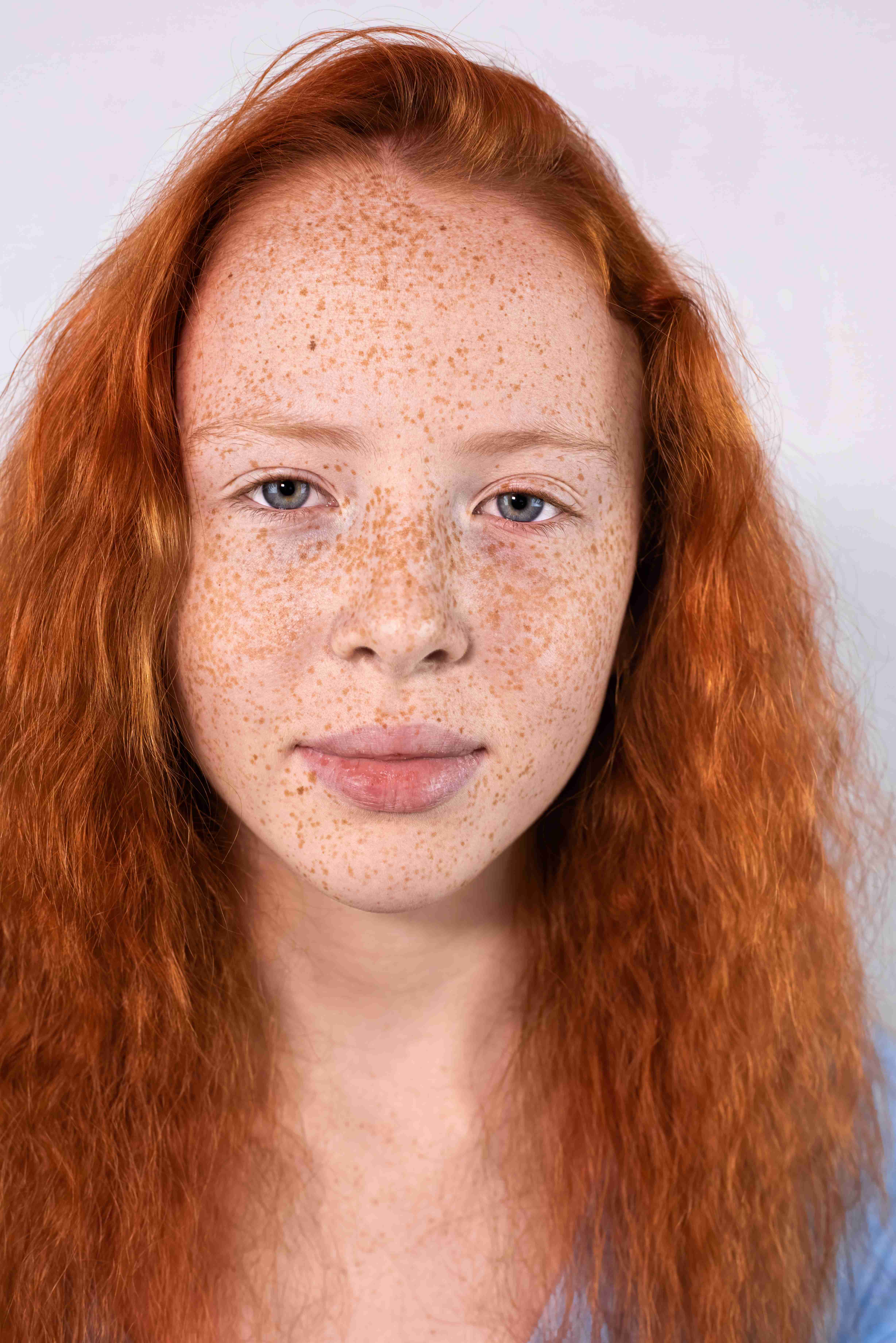 Steps of freckle removal