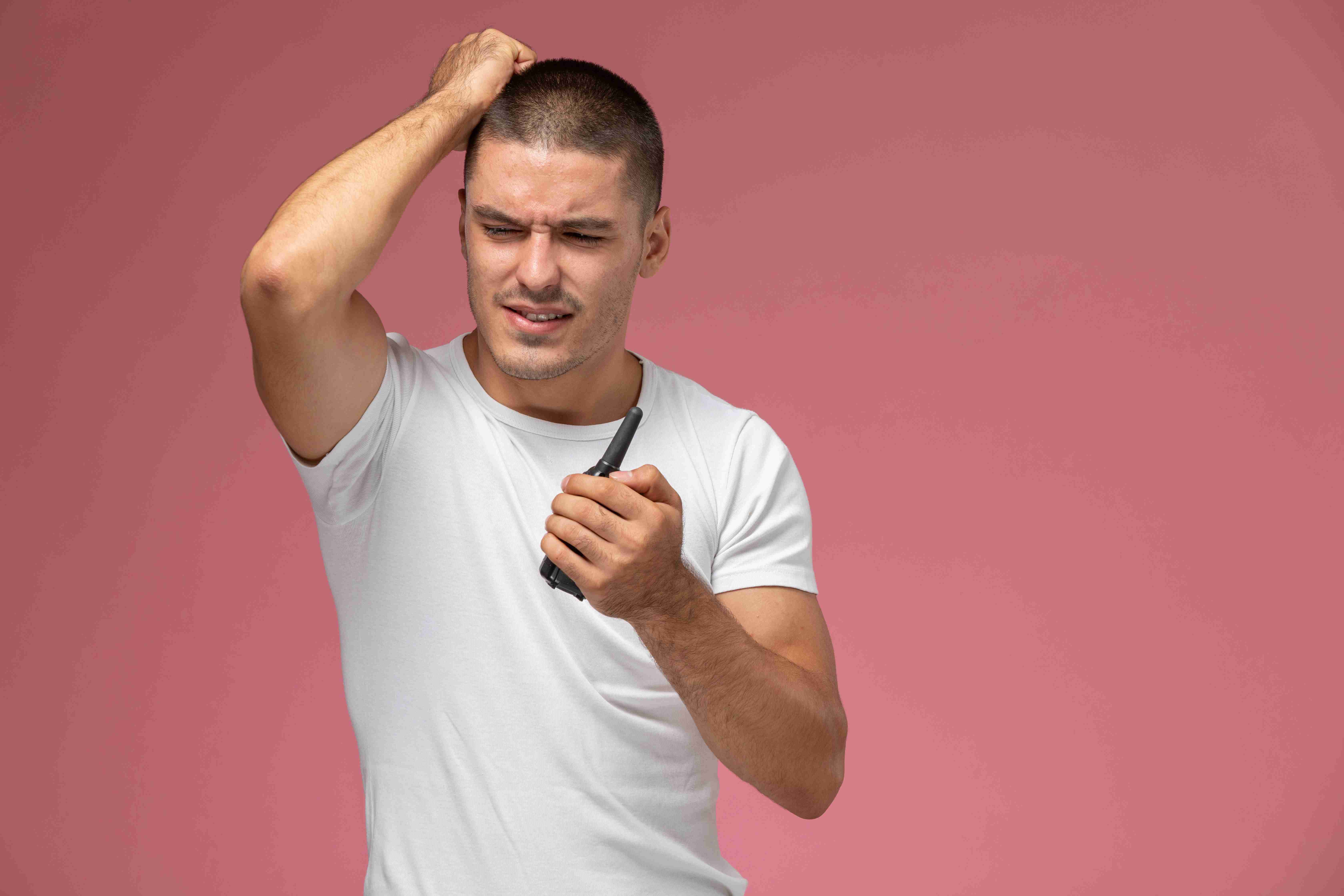 Thinning hair and receding hairline in men