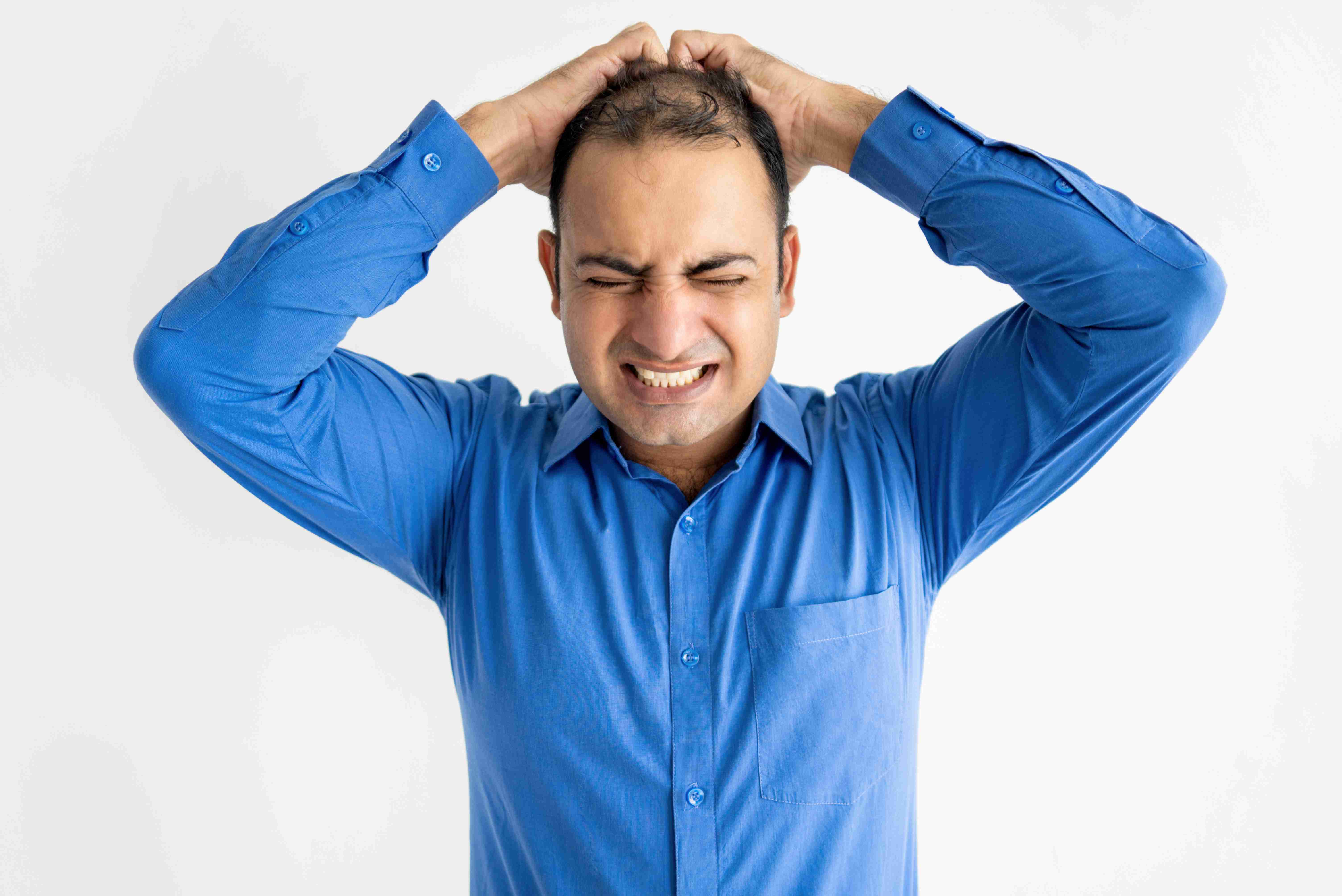 Topical and medical treatments for male hairfall