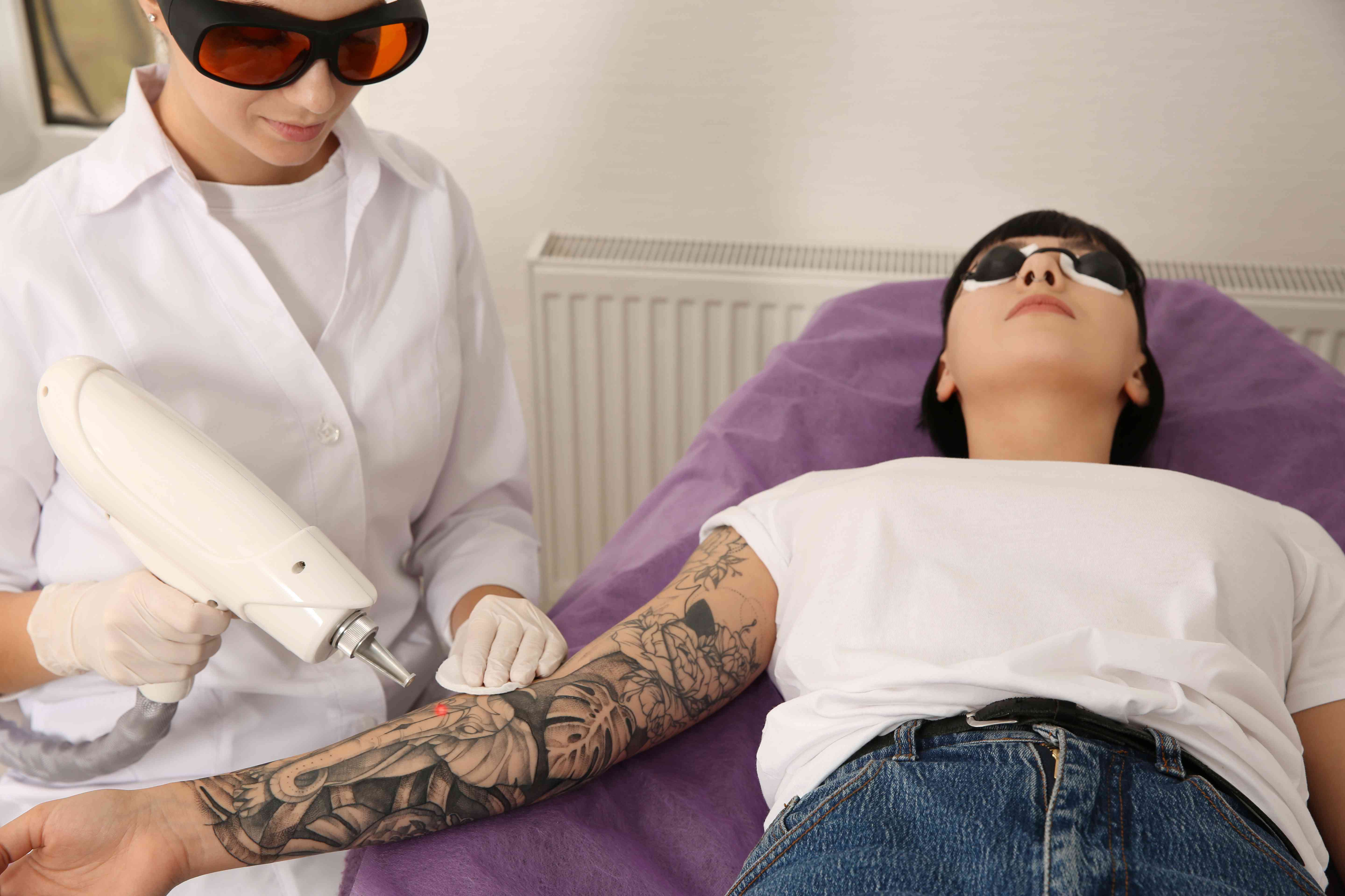 Tattoo removal healing progression