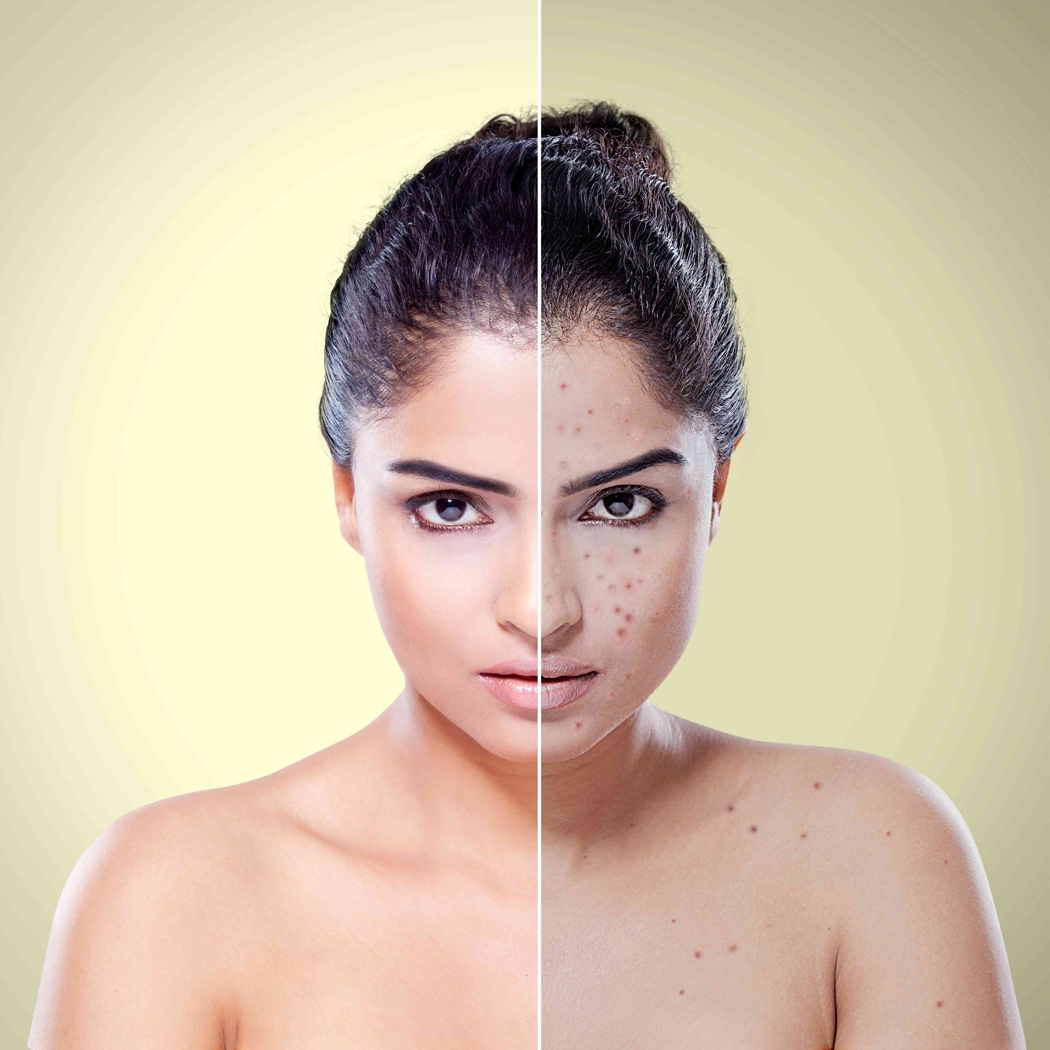 Results after mole removal