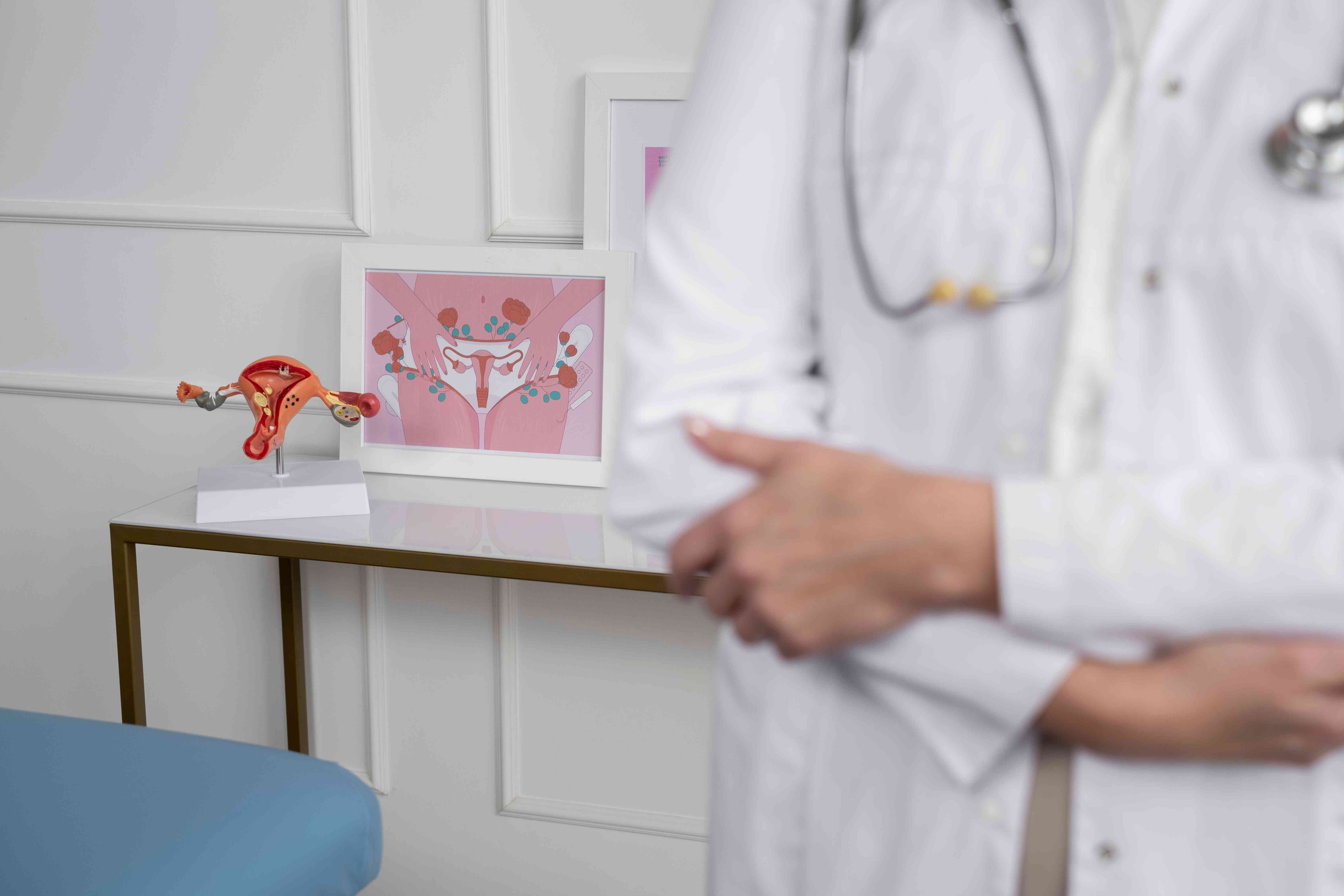 Causes of PCOD including hormonal and lifestyle factors