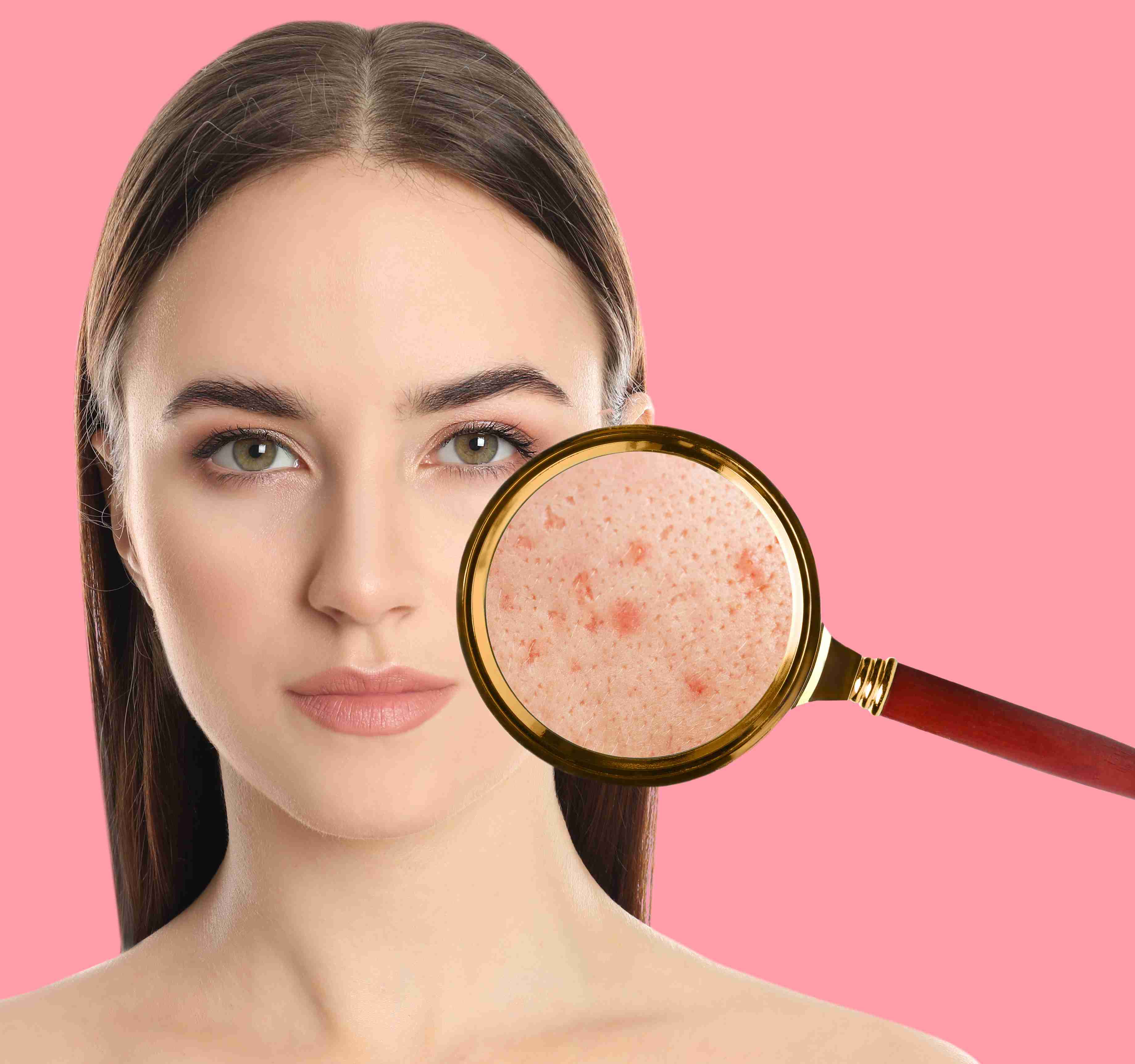 Before and after pigmentation removal