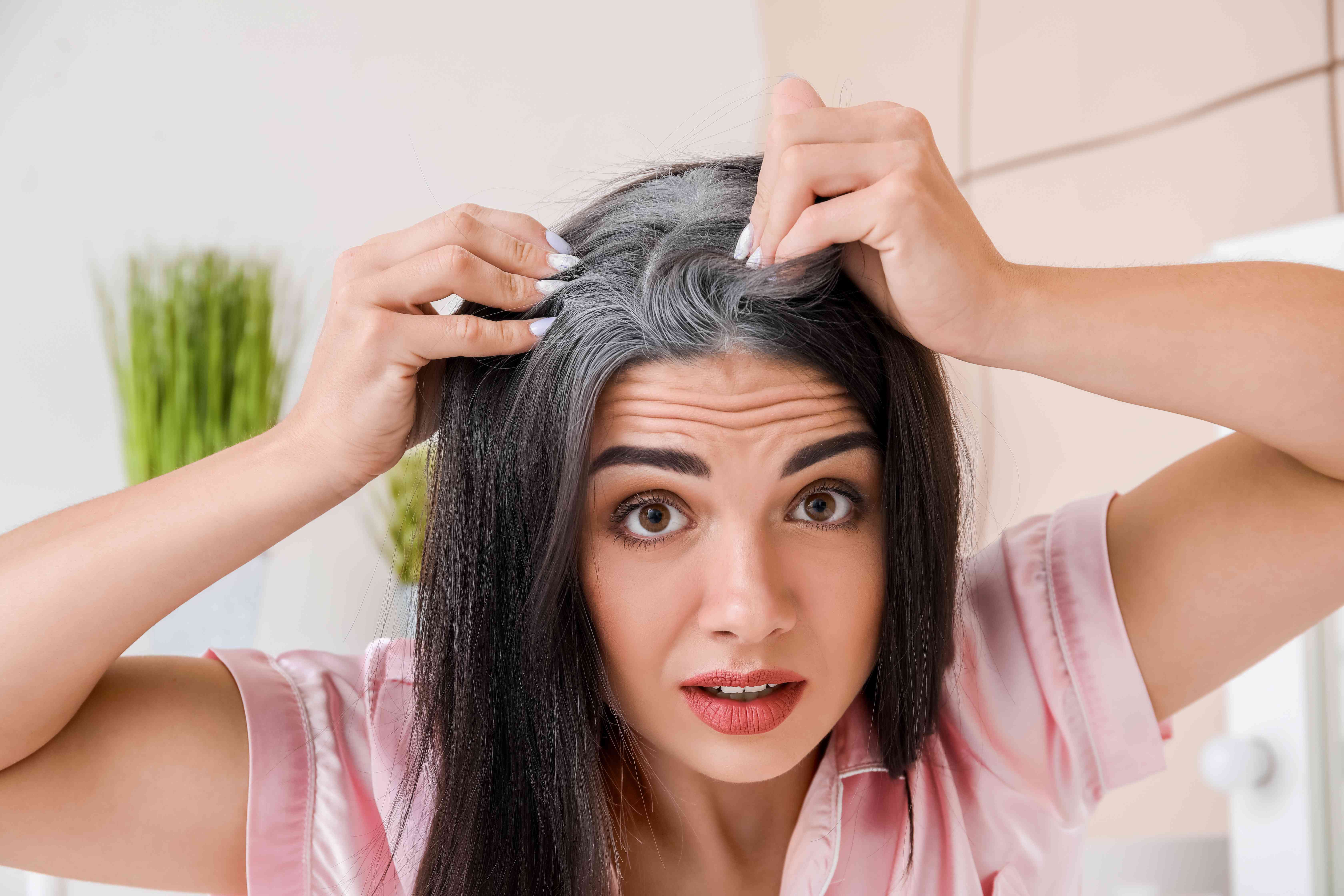 Results after treatment for premature greying