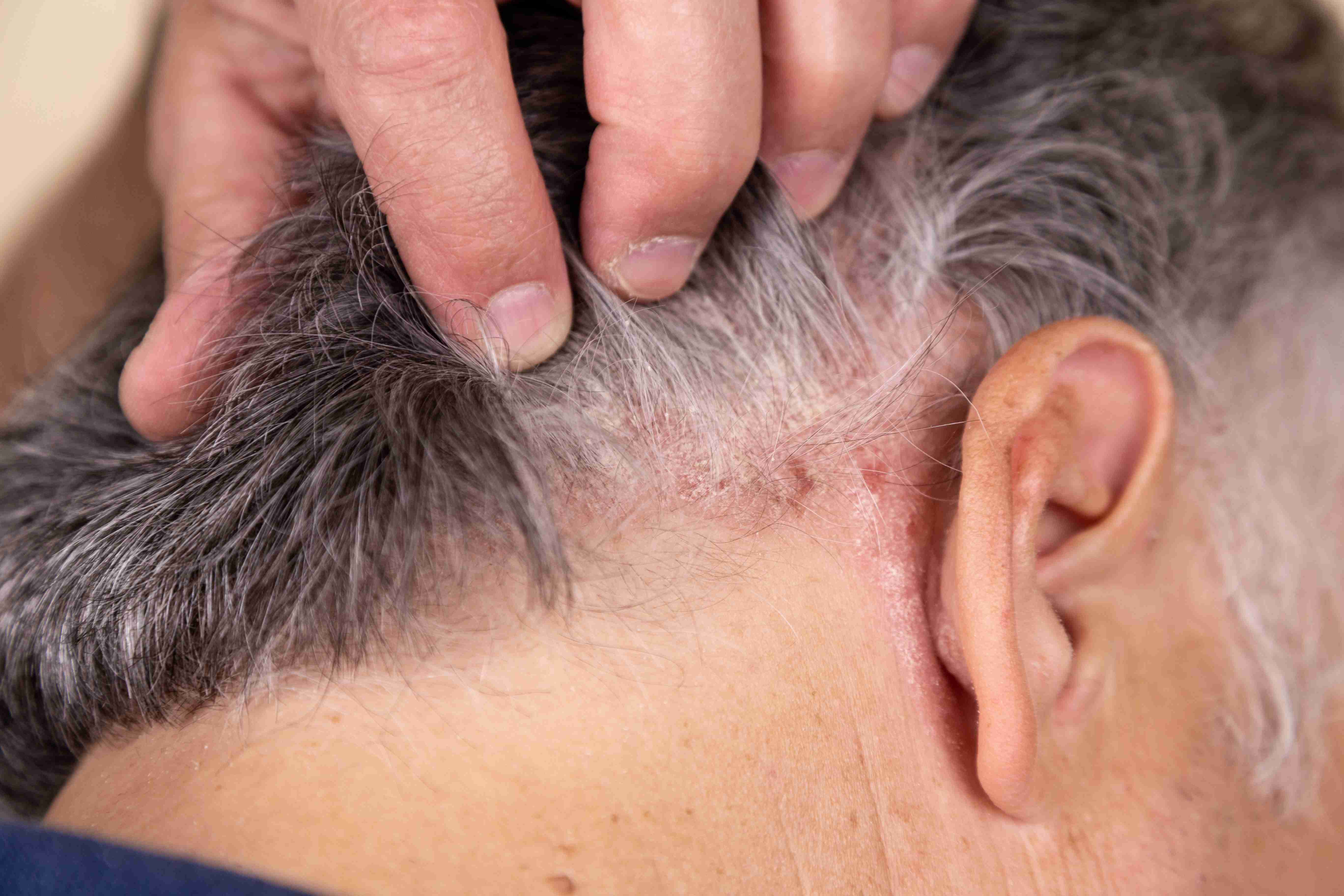 Woman using facial massage tools