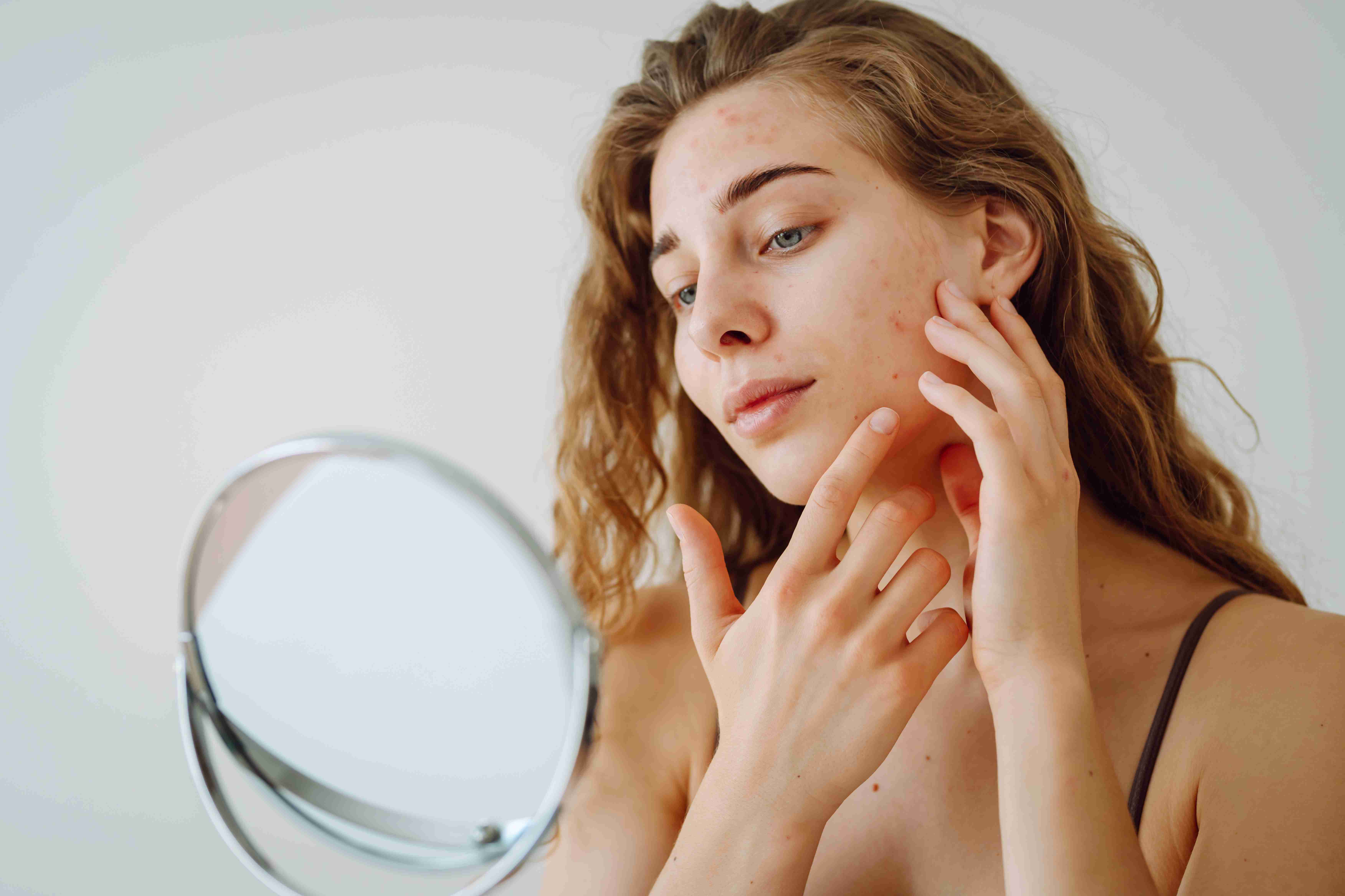 Redness and flaking due to skin sensitivity
