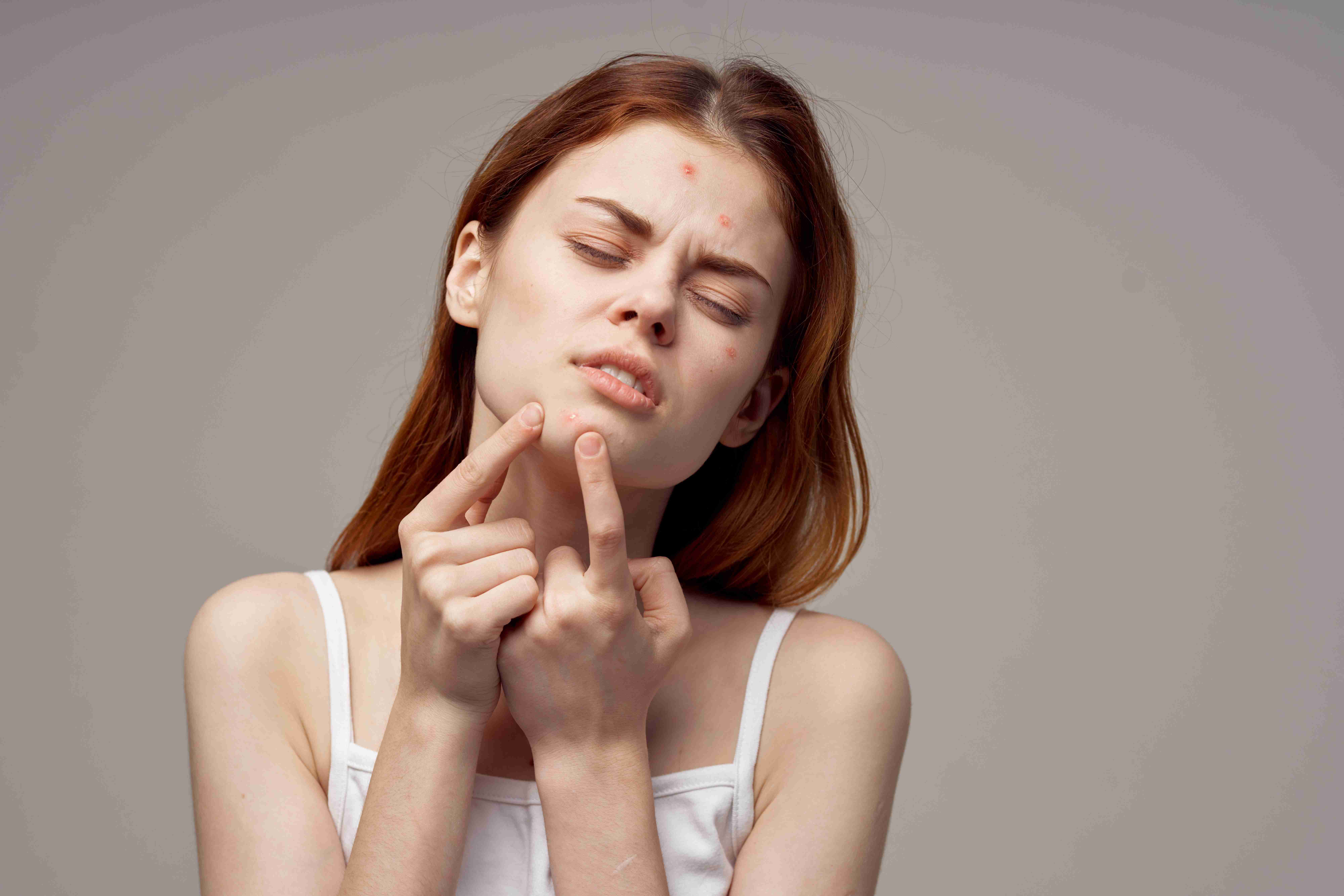 Skin reacting to weather and product