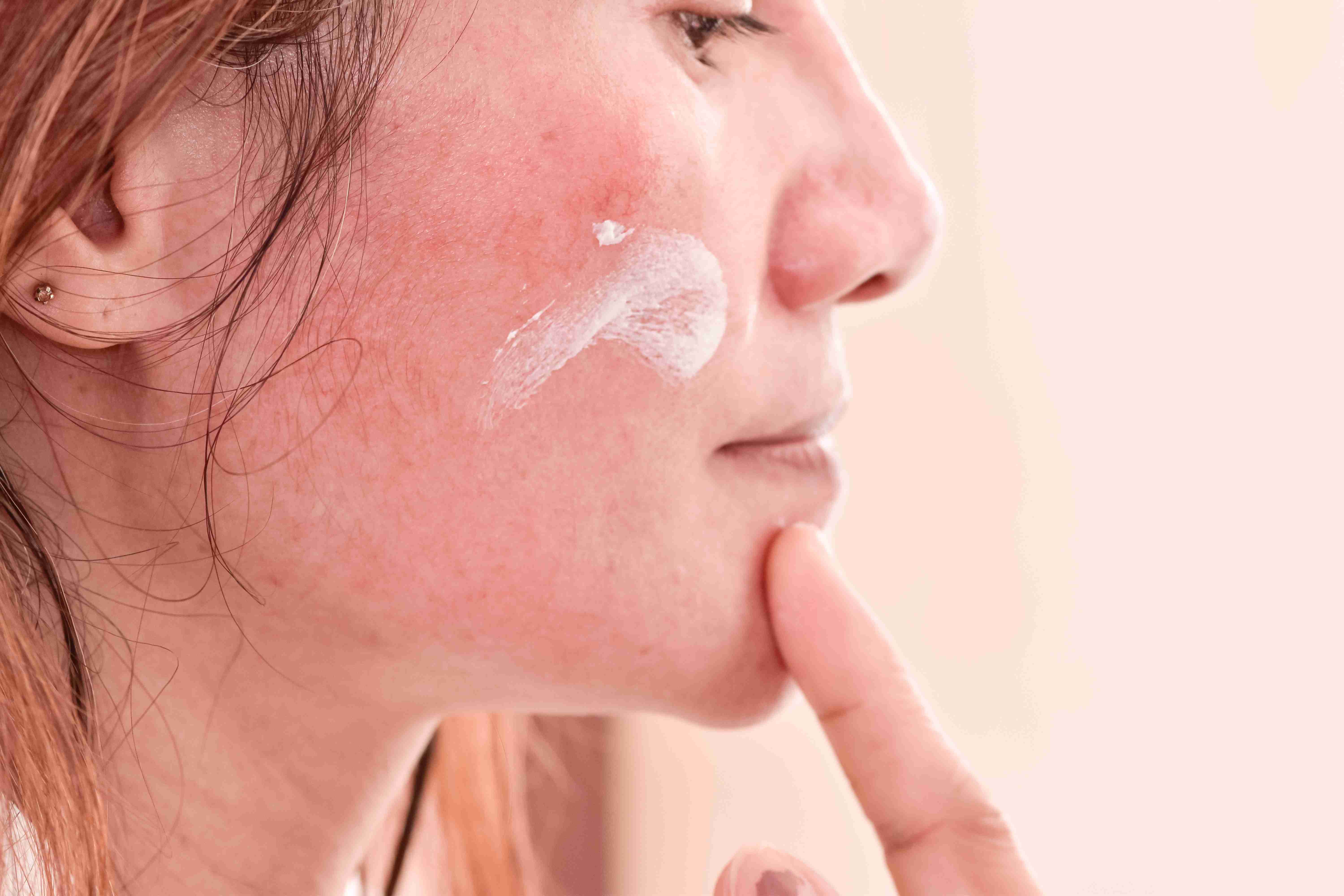 Steps to manage sensitive skin