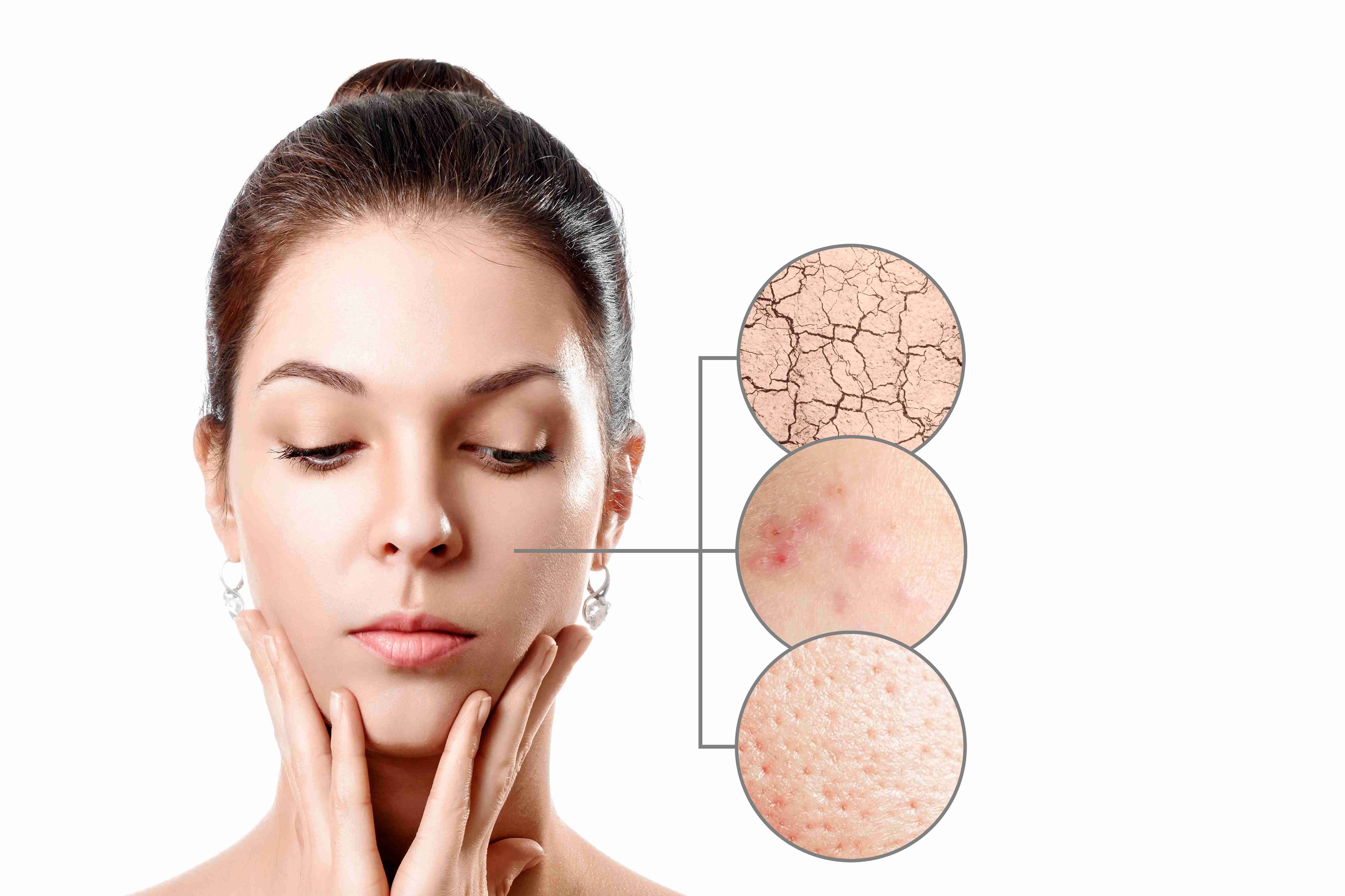 Skin after removal of tags with no scarring