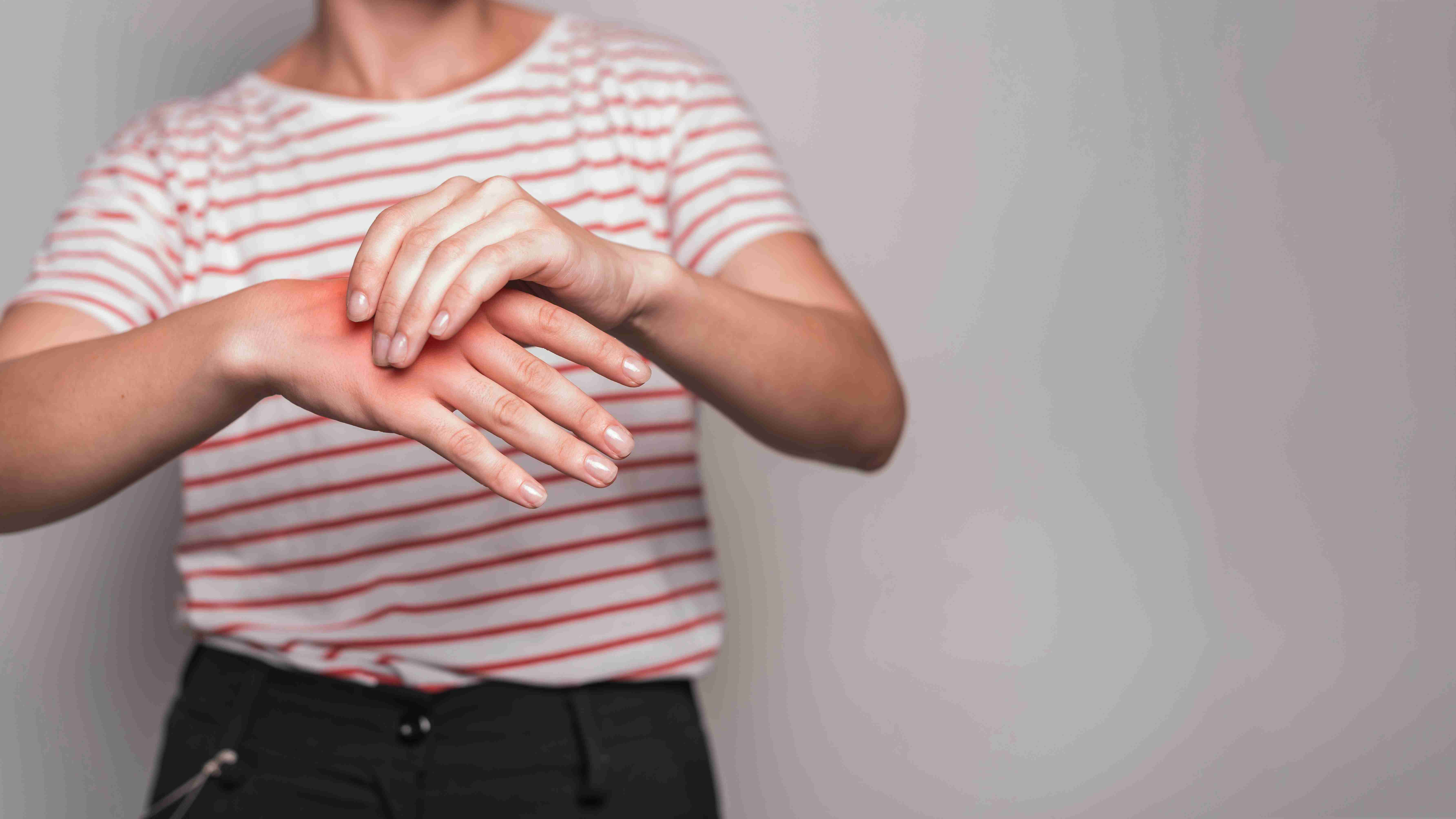 Dermatologist examining hives on skin