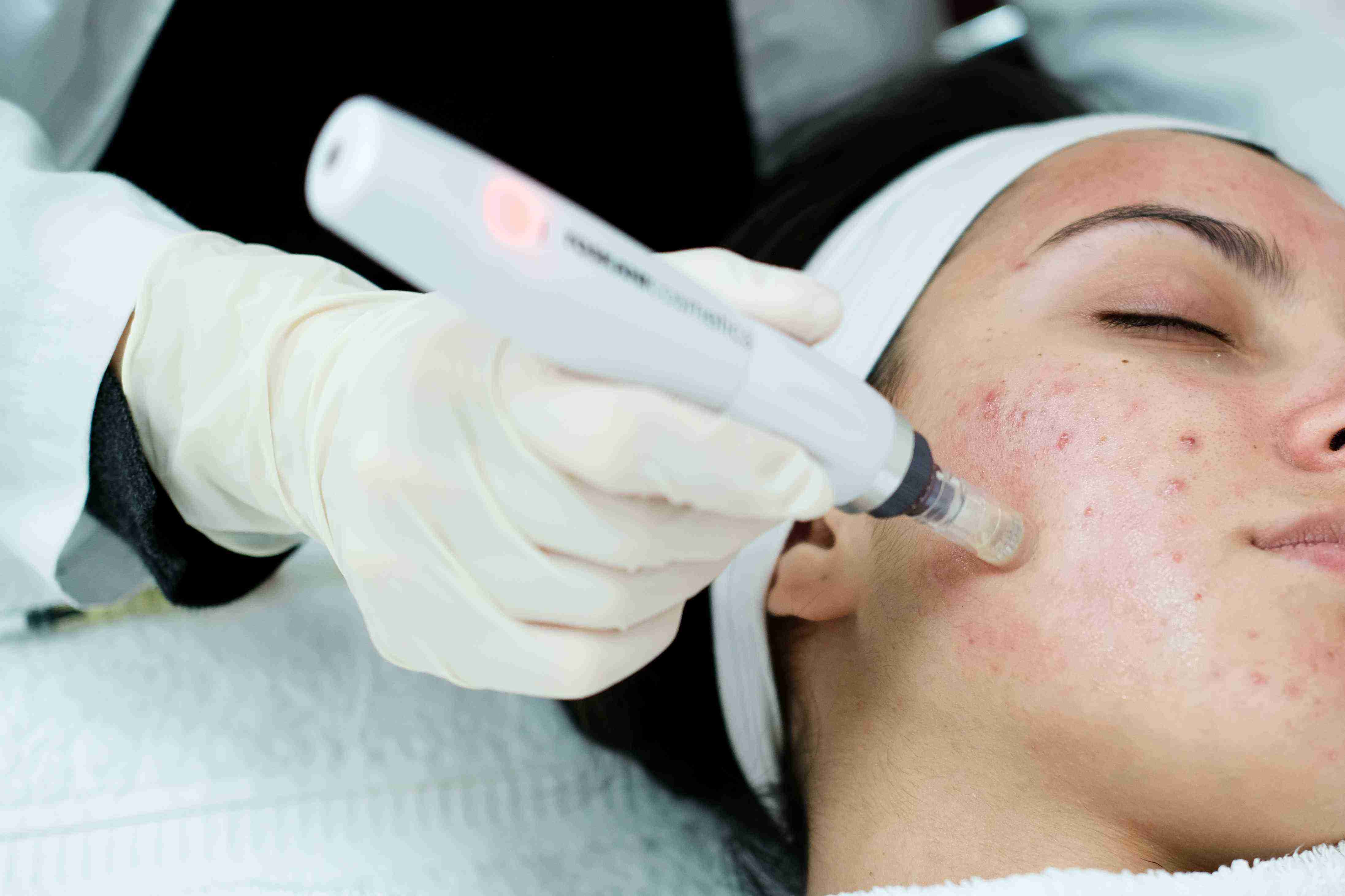 Woman using facial massage tools