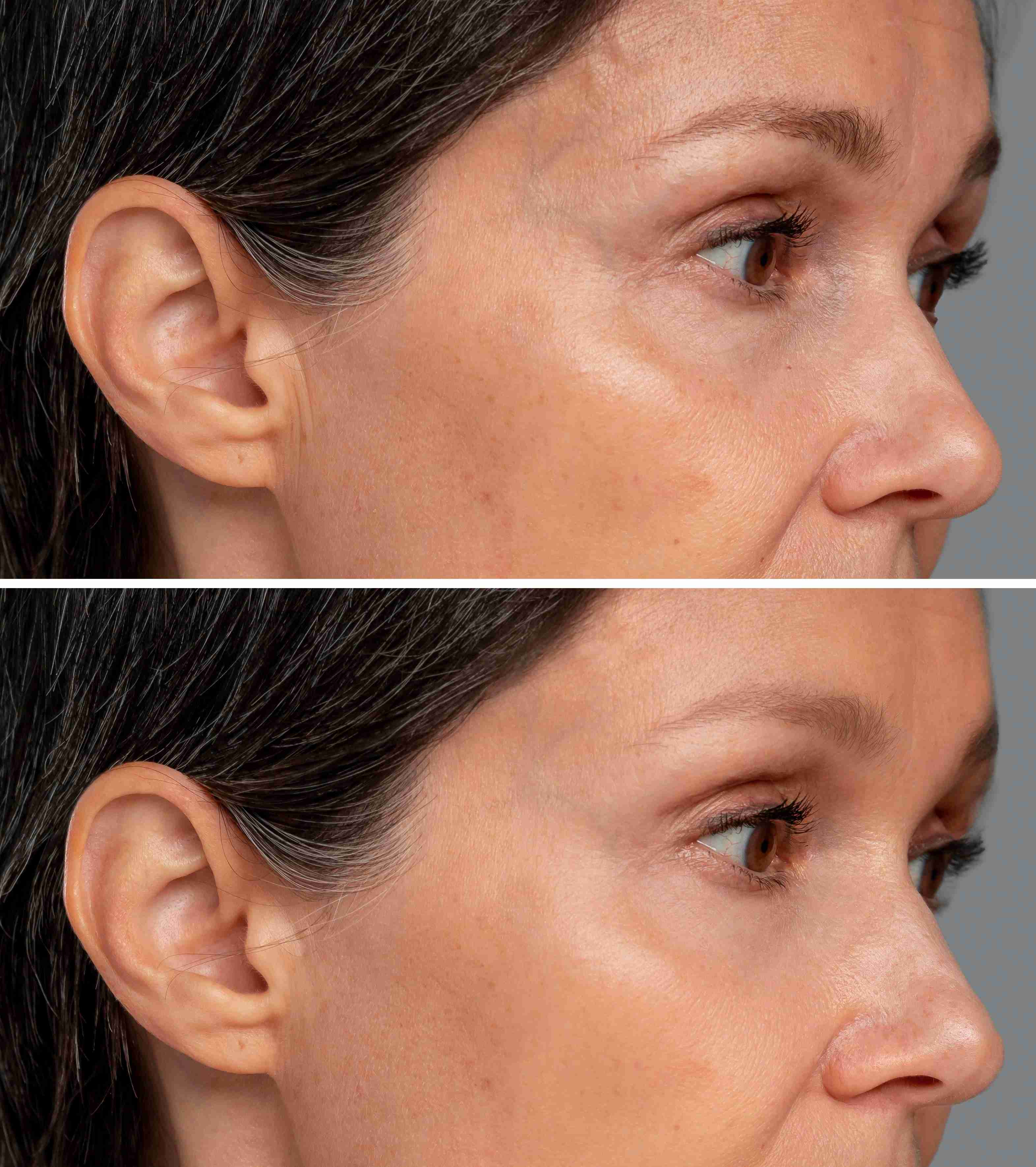 Woman using facial massage tools